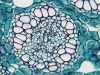 New Research Suggests Immune-Hiding Tumors Have Unexpected Weaknesses New Research Suggests Immune-Hiding Tumors Have Unexpected Weaknesses