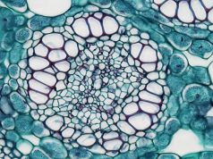 New Research Suggests Immune-Hiding Tumors Have Unexpected Weaknesses New Research Suggests Immune-Hiding Tumors Have Unexpected Weaknesses