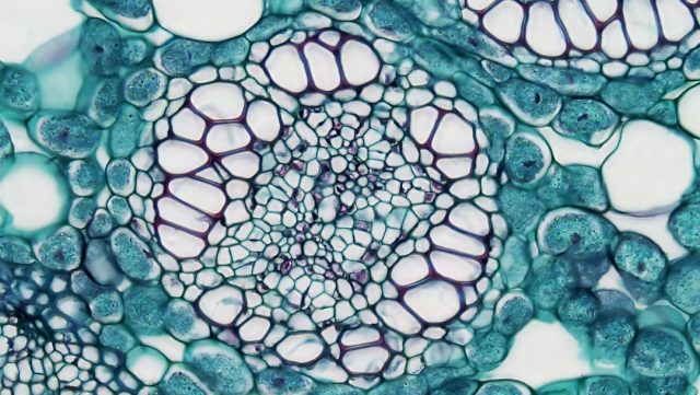 New Research Suggests Immune-Hiding Tumors Have Unexpected Weaknesses New Research Suggests Immune-Hiding Tumors Have Unexpected Weaknesses